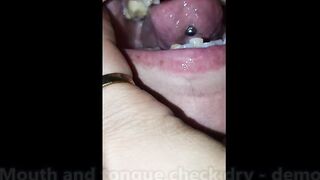 Mouth and tongue check dry - demo