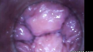 Spicy czech teenie opens up her taut crack to the extraordinary