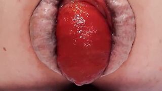 Anyone in the mood for an awesome close- up of an anal prolapse in various sizes
